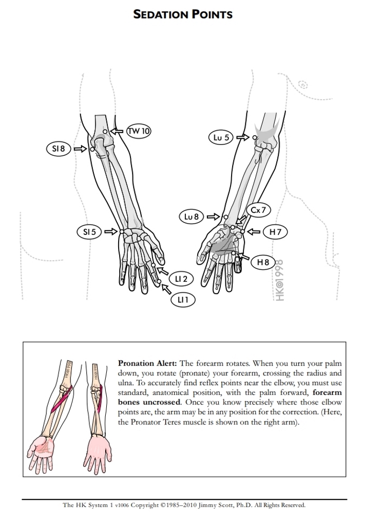 Sedation Points: Arms 