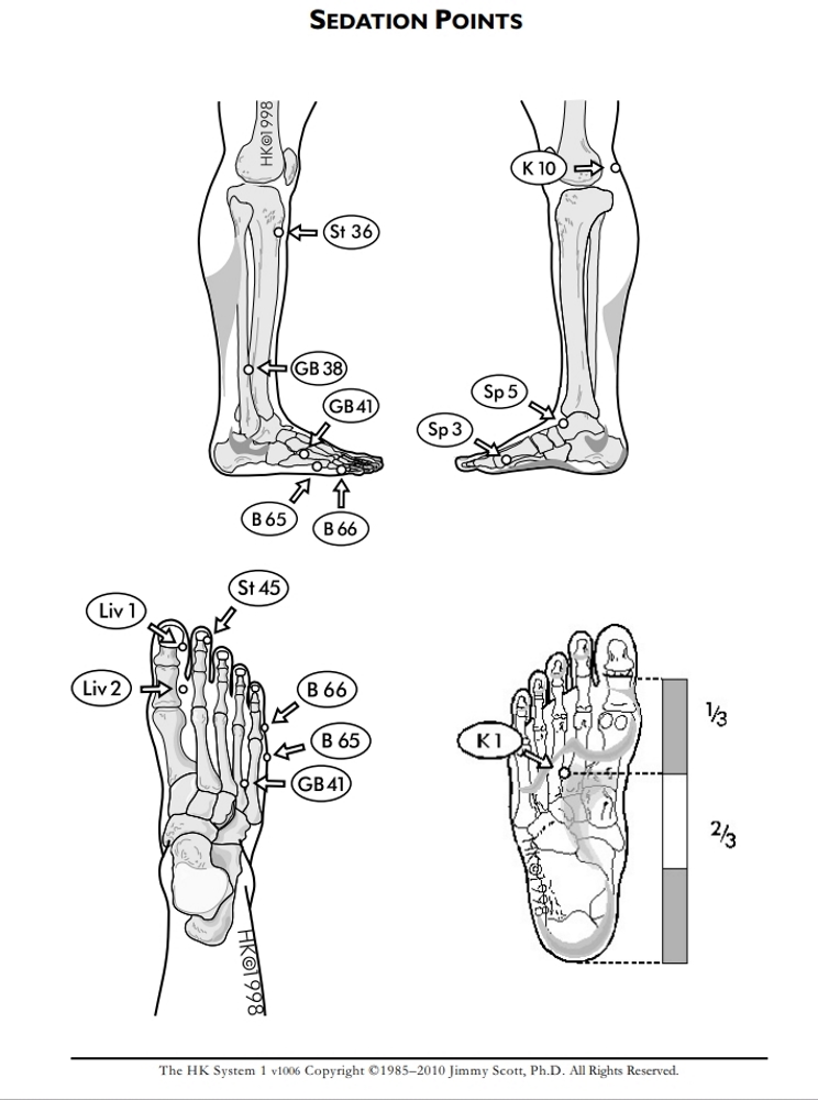 Sedation Points: Legs