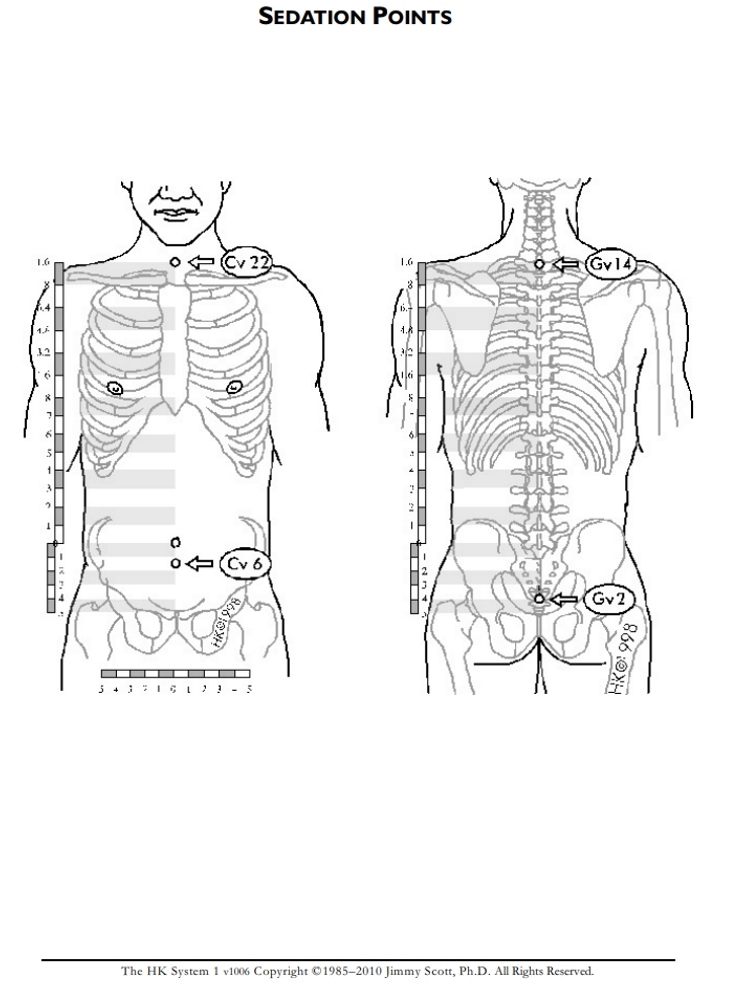 Reflex Sedation Points: Torso